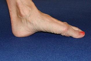 arched foot image